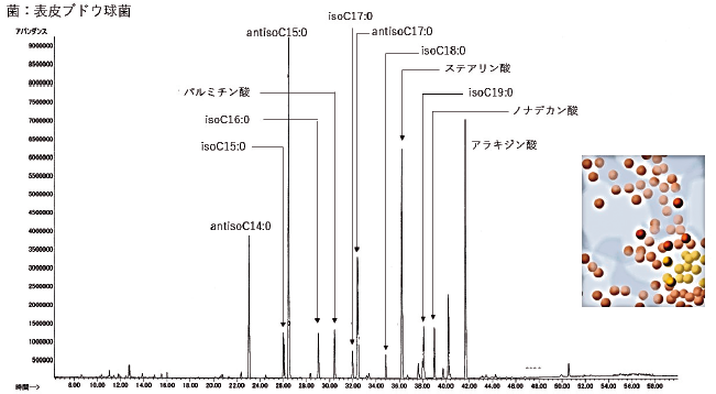 黄色ブドウ球菌